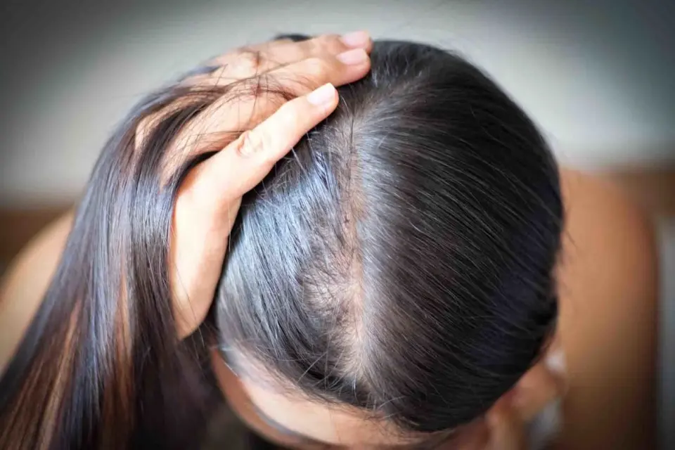 How to Dye Your Hair Without Causing Hair Loss